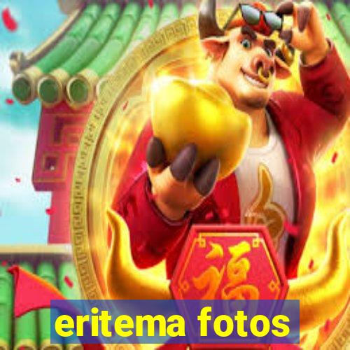 eritema fotos