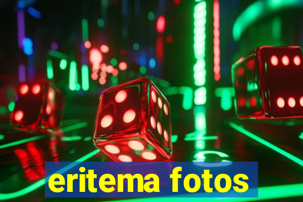 eritema fotos
